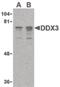 DEAD-Box Helicase 3 X-Linked antibody, PA5-20224, Invitrogen Antibodies, Western Blot image 