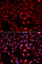 Pyruvate Kinase M1/2 antibody, A01173-1, Boster Biological Technology, Western Blot image 