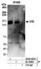 Cr2 antibody, A304-423A, Bethyl Labs, Immunoprecipitation image 