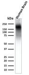 Neurofilament Heavy antibody, GTX02687, GeneTex, Western Blot image 