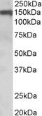 Phosphodiesterase 4D antibody, 46-151, ProSci, Immunohistochemistry paraffin image 