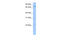 BFSP1 antibody, 29-267, ProSci, Western Blot image 