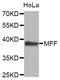 Mitochondrial Fission Factor antibody, STJ26928, St John