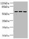 Zinc Finger Protein 19 antibody, A61934-100, Epigentek, Western Blot image 