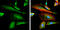 Protein Tyrosine Kinase 2 antibody, GTX129840, GeneTex, Immunofluorescence image 
