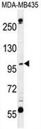 SWT1 RNA Endoribonuclease Homolog antibody, AP50691PU-N, Origene, Western Blot image 