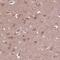 Zinc Finger Protein 292 antibody, NBP2-55356, Novus Biologicals, Immunohistochemistry frozen image 