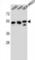 Tubulin Beta 6 Class V antibody, abx026508, Abbexa, Western Blot image 