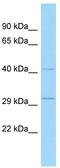 TSC22 Domain Family Member 4 antibody, TA329118, Origene, Western Blot image 