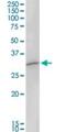 MAGE Family Member A8 antibody, H00004107-D01P, Novus Biologicals, Western Blot image 