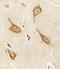 Phosphatidylinositol-5-Phosphate 4-Kinase Type 2 Alpha antibody, PA5-72201, Invitrogen Antibodies, Immunohistochemistry paraffin image 
