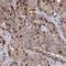 ACD Shelterin Complex Subunit And Telomerase Recruitment Factor antibody, HPA057660, Atlas Antibodies, Immunohistochemistry paraffin image 