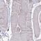 Transmembrane Protein 106C antibody, PA5-61466, Invitrogen Antibodies, Immunohistochemistry frozen image 