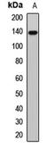 1-phosphatidylinositol-4,5-bisphosphate phosphodiesterase beta-1 antibody, LS-C668119, Lifespan Biosciences, Western Blot image 