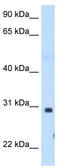 ST3 Beta-Galactoside Alpha-2,3-Sialyltransferase 3 antibody, TA339037, Origene, Western Blot image 