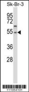 Protein Phosphatase, Mg2+/Mn2+ Dependent 1A antibody, 57-641, ProSci, Western Blot image 