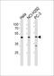 Nuclear Receptor Subfamily 0 Group B Member 1 antibody, PA5-12269, Invitrogen Antibodies, Western Blot image 