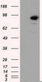 SATB Homeobox 1 antibody, LS-C114675, Lifespan Biosciences, Western Blot image 