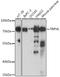 Transient Receptor Potential Cation Channel Subfamily V Member 6 antibody, A02139, Boster Biological Technology, Western Blot image 
