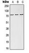 NDC80 Kinetochore Complex Component antibody, LS-C353255, Lifespan Biosciences, Western Blot image 
