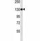 Toll Like Receptor 8 antibody, F43434-0.4ML, NSJ Bioreagents, Western Blot image 