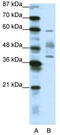 Aprataxin antibody, TA331580, Origene, Western Blot image 