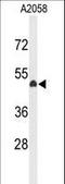 EYA Transcriptional Coactivator And Phosphatase 4 antibody, LS-C167872, Lifespan Biosciences, Western Blot image 