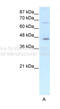 Estrogen Receptor 2 antibody, 27-386, ProSci, Enzyme Linked Immunosorbent Assay image 