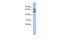 Programmed Cell Death 7 antibody, GTX44814, GeneTex, Western Blot image 
