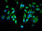 Centrosomal Protein 250 antibody, LS-C671620, Lifespan Biosciences, Immunofluorescence image 