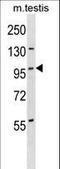 Serine/Threonine Kinase 11 Interacting Protein antibody, LS-C157105, Lifespan Biosciences, Western Blot image 