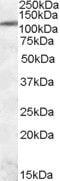 Ire1-alpha antibody, PA5-18941, Invitrogen Antibodies, Western Blot image 