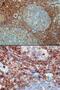 Rac Family Small GTPase 2 antibody, GTX22244, GeneTex, Immunohistochemistry paraffin image 