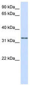 Trans-2,3-Enoyl-CoA Reductase antibody, TA346654, Origene, Western Blot image 