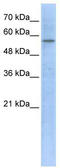 Hydroxymethylglutaryl-CoA synthase, cytoplasmic antibody, TA346705, Origene, Western Blot image 