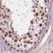 Ephrin B2 antibody, NBP2-49646, Novus Biologicals, Immunohistochemistry paraffin image 