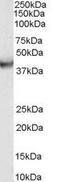 Vacuolar protein sorting-associated protein 37C antibody, GTX89444, GeneTex, Western Blot image 