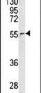 Nucleoporin 62 antibody, PA5-14405, Invitrogen Antibodies, Western Blot image 