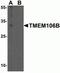 Transmembrane protein 106B antibody, NBP2-82027, Novus Biologicals, Western Blot image 