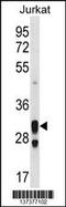 Alkaline Ceramidase 1 antibody, 60-034, ProSci, Western Blot image 