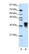 Transformer 2 Beta Homolog antibody, NBP1-57456, Novus Biologicals, Western Blot image 