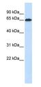 Frizzled Class Receptor 4 antibody, ab83042, Abcam, Western Blot image 