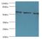 Coilin antibody, LS-C375487, Lifespan Biosciences, Western Blot image 