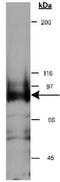 Sperm Antigen With Calponin Homology And Coiled-Coil Domains 1 antibody, GTX30651, GeneTex, Western Blot image 