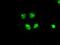 B-Raf Proto-Oncogene, Serine/Threonine Kinase antibody, NBP1-47668, Novus Biologicals, Immunocytochemistry image 
