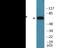 Microtubule Associated Protein Tau antibody, EKC2533, Boster Biological Technology, Western Blot image 