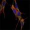 SMAD Family Member 4 antibody, NBP1-51646, Novus Biologicals, Immunocytochemistry image 