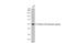 Retinoic Acid Receptor Gamma antibody, GTX102914, GeneTex, Western Blot image 