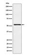 ATPase H+/K+ Transporting Subunit Beta antibody, M08719, Boster Biological Technology, Western Blot image 