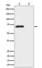 Checkpoint Kinase 2 antibody, P00277-1, Boster Biological Technology, Western Blot image 